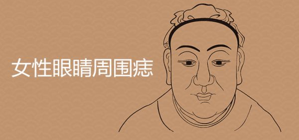 女性眼睛周围痣图解大全