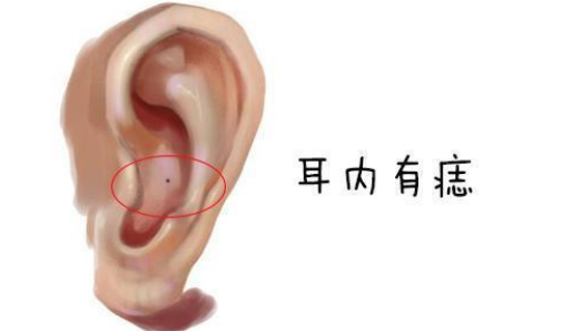 耳朵痣相详解：你知道耳朵上长痣都代表什么吗