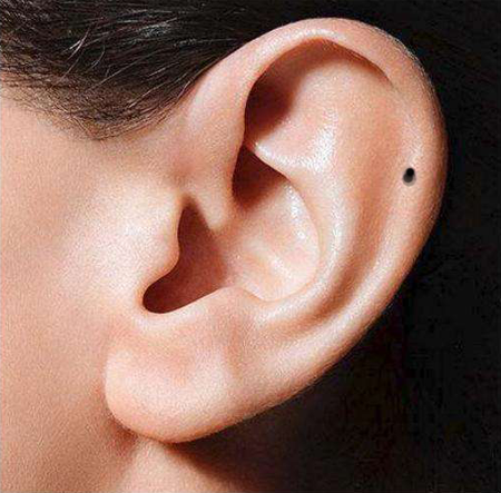 耳朵的活痣代表什么