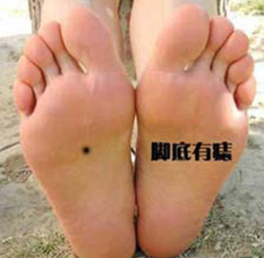 男人右脚底有痣代表什么