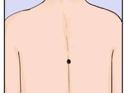 男人背部痣相图解 背部有痣代表什么？