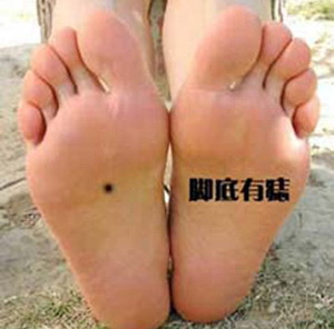 男人右脚底有痣的含义