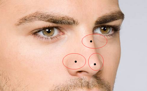 男人鼻子上有痣代表什么，一起来看看插图