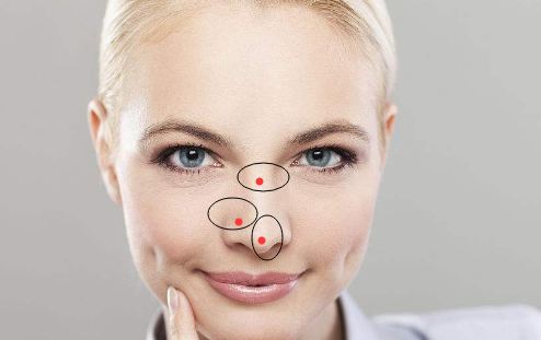 女人鼻子有痣代表什么，鼻子有痣的女人好吗插图